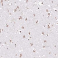 Anti-TUBGCP2 antibody produced in rabbit 
