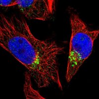 Anti-TVP23B antibody produced in rabbit 