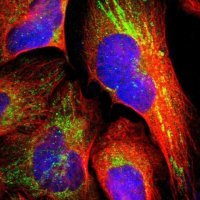 Anti-TXNDC16 antibody produced in rabbit 