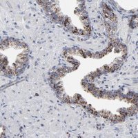 Anti-TXNRD2 antibody produced in rabbit HPA003323-100UL