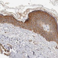 Anti-TYK2 antibody produced in rabbit 