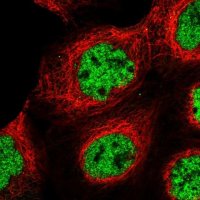 Anti-U2SURP antibody produced in rabbit HPA037545-100UL