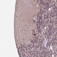 Anti-UBA3 antibody produced in rabbit HPA034874-100UL