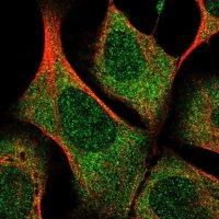 Anti-UBALD1 antibody produced in rabbit 