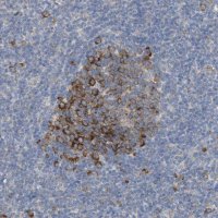 Anti-UBAP2 antibody produced in rabbit 