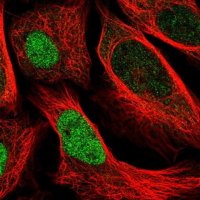 Anti-UBE2E2 antibody produced in rabbit 