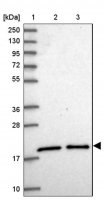 Anti-UBE2G1 antibody produced in rabbit HPA045681-100UL