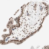 Anti-UBE2I antibody produced in rabbit 