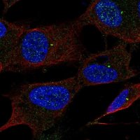 Anti-UBE2Q1 antibody produced in rabbit 