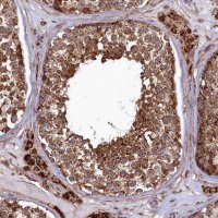 Anti-UBE3B antibody produced in rabbit 