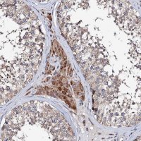 Anti-UBE3C antibody produced in rabbit 
