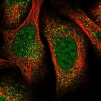 Anti-UBR1 antibody produced in rabbit 