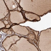 Anti-UBR2 antibody produced in rabbit 