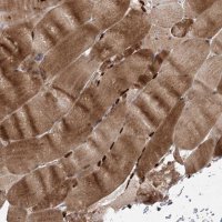 Anti-UBR3 antibody produced in rabbit HPA035390-100UL