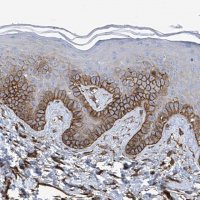 Anti-UBTD1 antibody produced in rabbit 