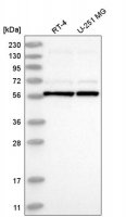 Anti-UBXN11 antibody produced in rabbit 