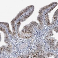 Anti-UCK1 antibody produced in rabbit 