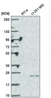 Anti-UCK2 antibody produced in rabbit 