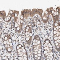 Anti-UGCG antibody produced in rabbit 