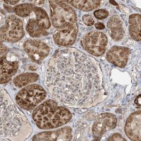 Anti-UQCC1 antibody produced in rabbit 