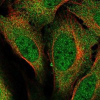 Anti-URI1 antibody produced in rabbit 