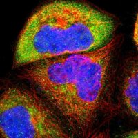 Anti-USP31 antibody produced in rabbit 
