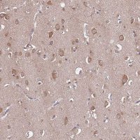 Anti-USP32 antibody produced in rabbit 