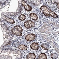 Anti-USP45 antibody produced in rabbit 