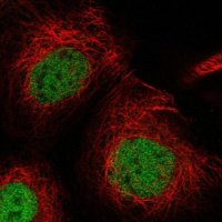 Anti-USP53 antibody produced in rabbit 