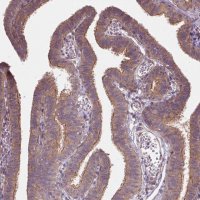 Anti-USP8 antibody produced in rabbit 