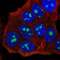 Anti-UTP14C antibody produced in rabbit 