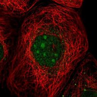 Anti-UTP23 antibody produced in rabbit 