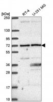 Anti-UTP6 antibody produced in rabbit HPA055806-100UL