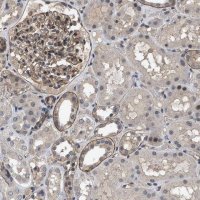 Anti-UTRN antibody produced in rabbit 