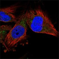 Anti-VDAC3 antibody produced in rabbit HPA026864-100UL