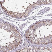 Anti-VGLL3 antibody produced in rabbit 
