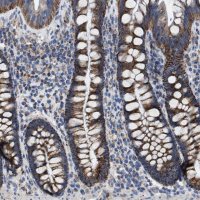 Anti-VPS13A antibody produced in rabbit 