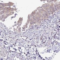 Anti-VPS4B antibody produced in rabbit 