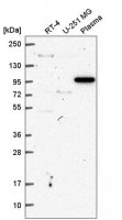 Anti-VPS54 antibody produced in rabbit HPA070582-100UL