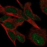 Anti-VSTM4 antibody produced in rabbit 