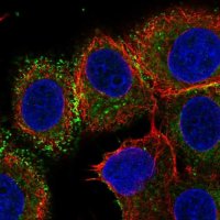 Anti-VTCN1 antibody produced in rabbit 