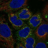 Anti-VTN antibody produced in rabbit 