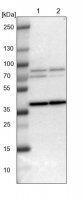 Anti-WBSCR17 antibody produced in rabbit 