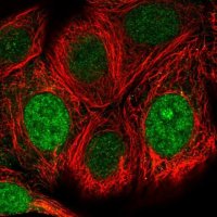 Anti-WBSCR22 antibody produced in rabbit 