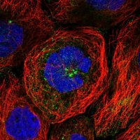 Anti-WDR11 antibody produced in rabbit 