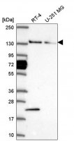 Anti-WDR19 antibody produced in rabbit 