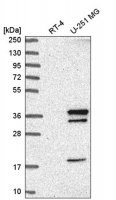Anti-WDR82 antibody produced in rabbit 