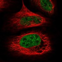 Anti-WDR92 antibody produced in rabbit 