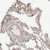 Anti-WFS1 antibody produced in rabbit 