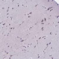 Anti-WNT9B antibody produced in rabbit 